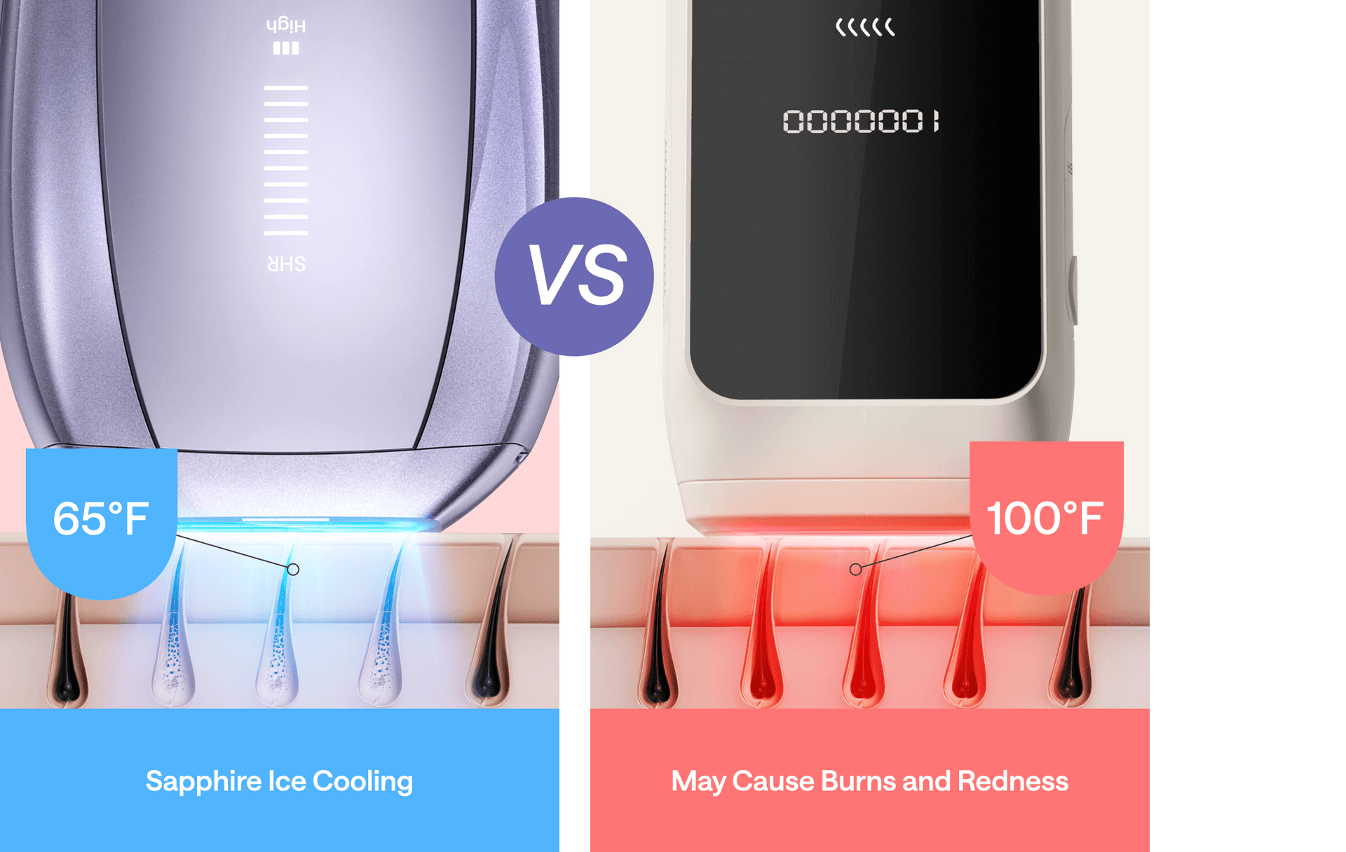 Comparison of IPL hair removal devices: Sapphire Ice Cooling at 65°F vs. traditional device at 100°F, highlighting reduced risk of burns and redness.