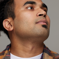 Before and after facial hair removal comparison on a man, showing reduced beard growth and smoother skin.