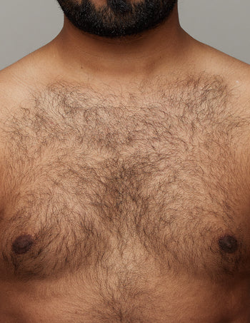 Before effective IPL Hair Removal for Chest area with Ulike Air