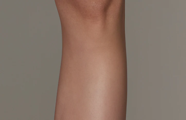 The effect of using ulike air 10 after leg hair removal